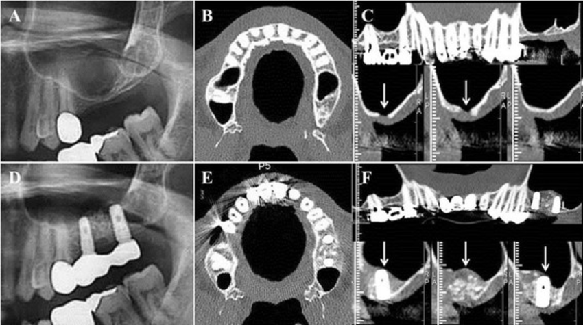 jawbone CT jawbone CT