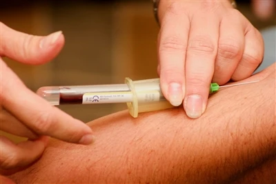 Spinal Needle + Tillverkare: Industry Trends And Future Challenges Outlook