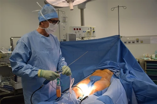 Den fysiologiska effekten av Veress-nålen vid Pneumoperitoneum-etablering och...